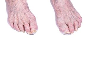 Effective Foot Care Tips for Seniors