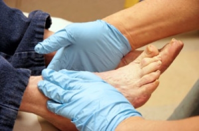 How Podiatrists Support Diabetics in Foot Protection